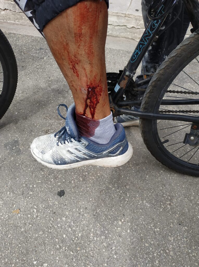 Κ. ΑΧΑΪΑ - ΠΡΟΣΟΧΗ ΣΚΛΗΡΕΣ ΕΙΚΟΝΕΣ: Αδέσπότα δάγκωσαν ποδηλάτη και "πετσόκοψαν" ένα σκυλί! Κινδύνευσαν παιδιά