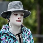 Επίθεση με βιτριόλι-Ιατροδικαστής: «Είναι εκπληκτικό το πώς η Ιωάννα κατάφερε και γλίτωσε»