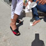 Επίθεση αδέσποτων σε πολίτες στο Λάππα- Τραυματίστηκαν στα χέρια και στα πόδια
