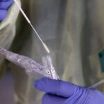 Αχαΐα: Πού θα γίνουν δωρεάν rapid tests την Τετάρτη