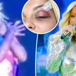 Bebe Rexha: Θεατής της έριξε κινητό στο πρόσωπο ενώ τραγουδούσε – Συνελήφθη 27χρονος