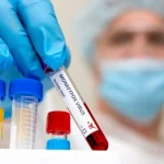 Ευλογιά των πιθήκων: Νέο στέλεχος του ιού mpox – Πόσο απειλεί την Ευρώπη