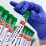 Ευλογιά των πιθήκων: Αποτελεσματικό το εμβόλιο, όχι τα αντιικά – Ποιοι κινδυνεύουν περισσότερο, ευάλωτα και τα παιδιά