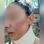 «Με χτυπούσε στο τιμόνι, μου έλεγε θα σε τελειώσω» – Σοκάρει η σύντροφος του πυροσβέστη που αναζητείται