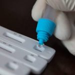 Αχαΐα: Πού θα γίνουν δωρεάν rapid tests αύριο Τετάρτη