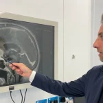 Έλληνας γιατρός στην Σκωτία εξέλιξε επαναστατική τεχνική – Αφαιρεί όγκους από τον εγκέφαλο μέσω των φρυδιών χωρίς κρανιεκτομή