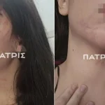 29χρονη πήγε για διακοπές με τον σύντροφο της και έζησε τον απόλυτο εφιάλτη – Την ξυλοκόπησε βάναυσα και την παράτησε στον δρόμο