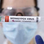 Συναγερμός στον ΕΟΔΥ: 18 κρούσματα της νόσου Mpox τις τελευταίες 50 ημέρες στην Ελλάδα