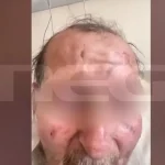 Θεσσαλονίκη: Την Τρίτη η απολογία του 60χρονου που προκάλεσε το τροχαίο στον Λαγκαδά με θύμα την 50χρονη