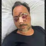 Ελεύθεροι οι δύο κατηγορούμενοι για τον ξυλοδαρμό του Ελληνοκαναδού χρηματιστή στο Ηράκλειο
