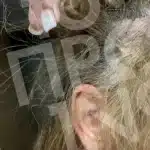 43χρονη καταγγέλλει ότι έπεσε θύμα ξυλοδαρμού στη μέση του δρόμου από γιατρό