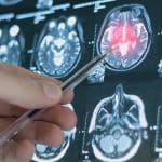 Ερευνα: Η εφηβεία διαρκεί μέχρι τα 30